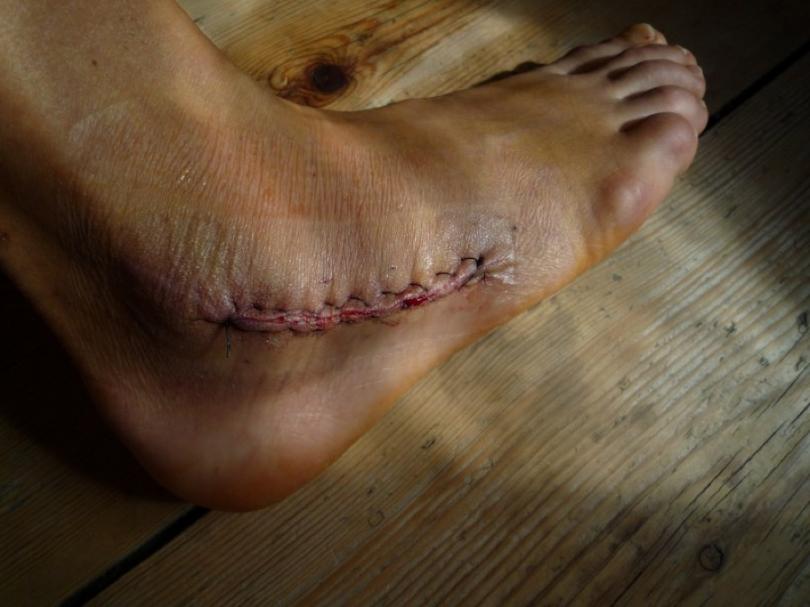 24_image-52c9f8cd50562-climbingstory-0005